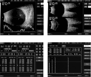 AB-6100 Screenshots