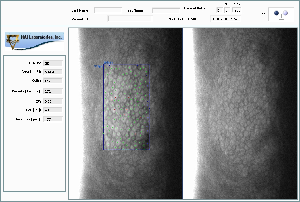 CL-1000eva Software