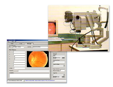 Fundus digital upgrade